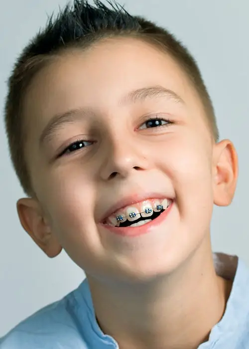 Early Orthodontic Treatment