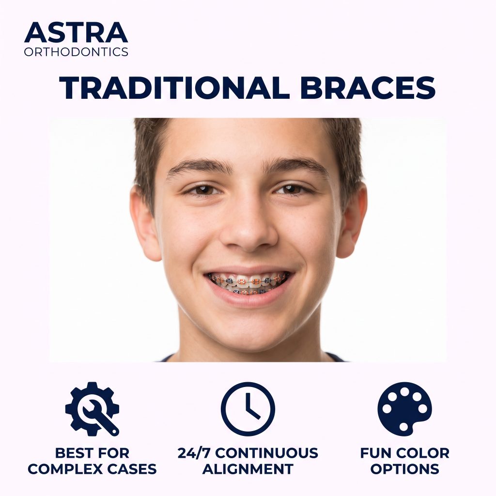 Traditional braces